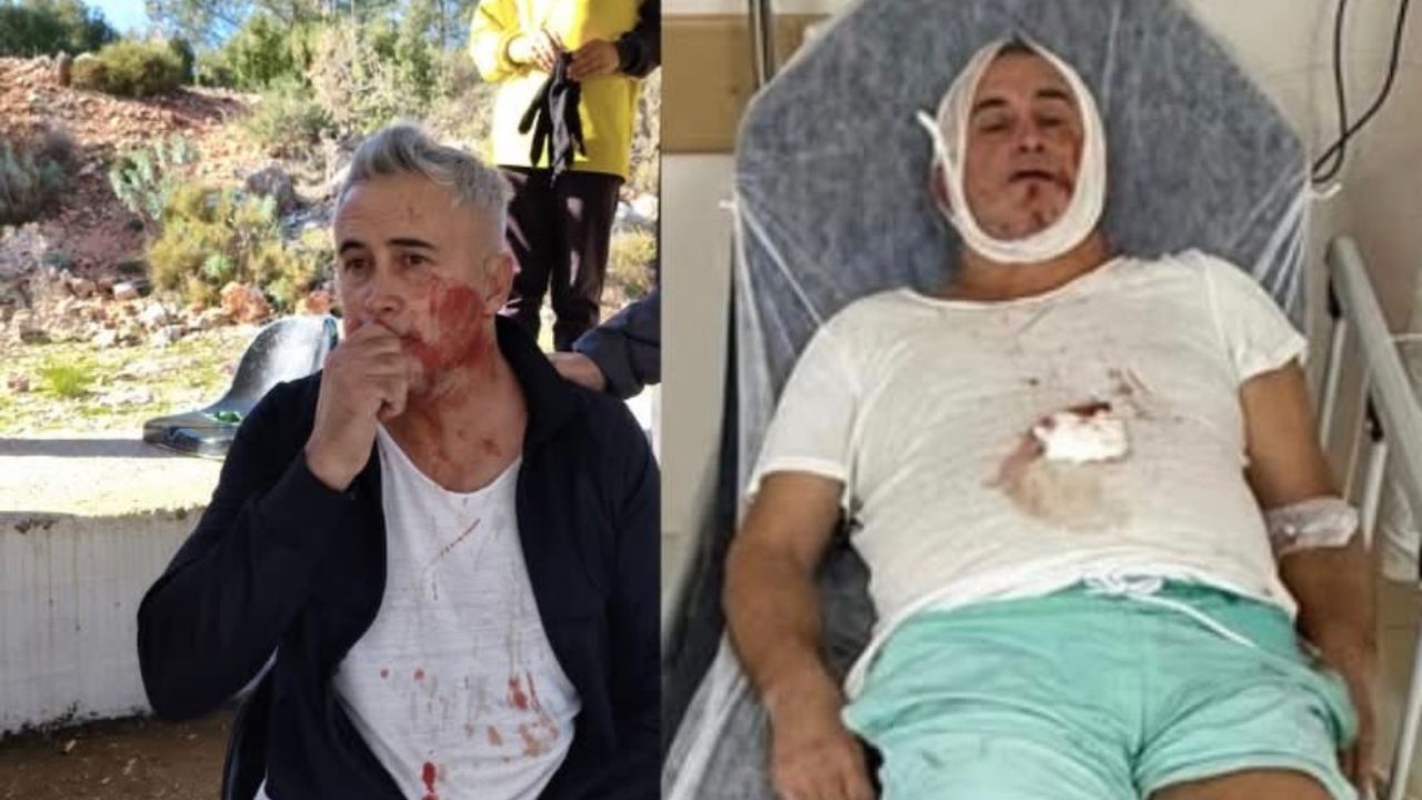 U14 maçı sonrası şiddet iddiası: Veli hastanede