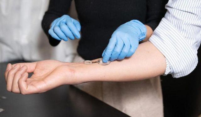 Enfeksiyonu günler önceden tespit eden akıllı bandaj: Caltech’ten iCares devrimi