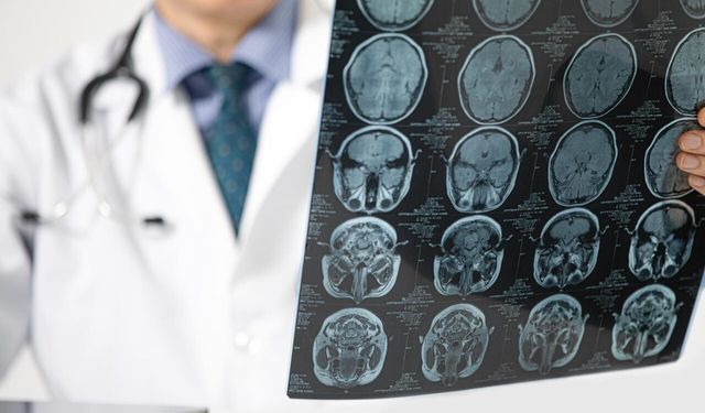 Genetik kodda gizli tehlike: Erkeklerde demans riski yükseliyor